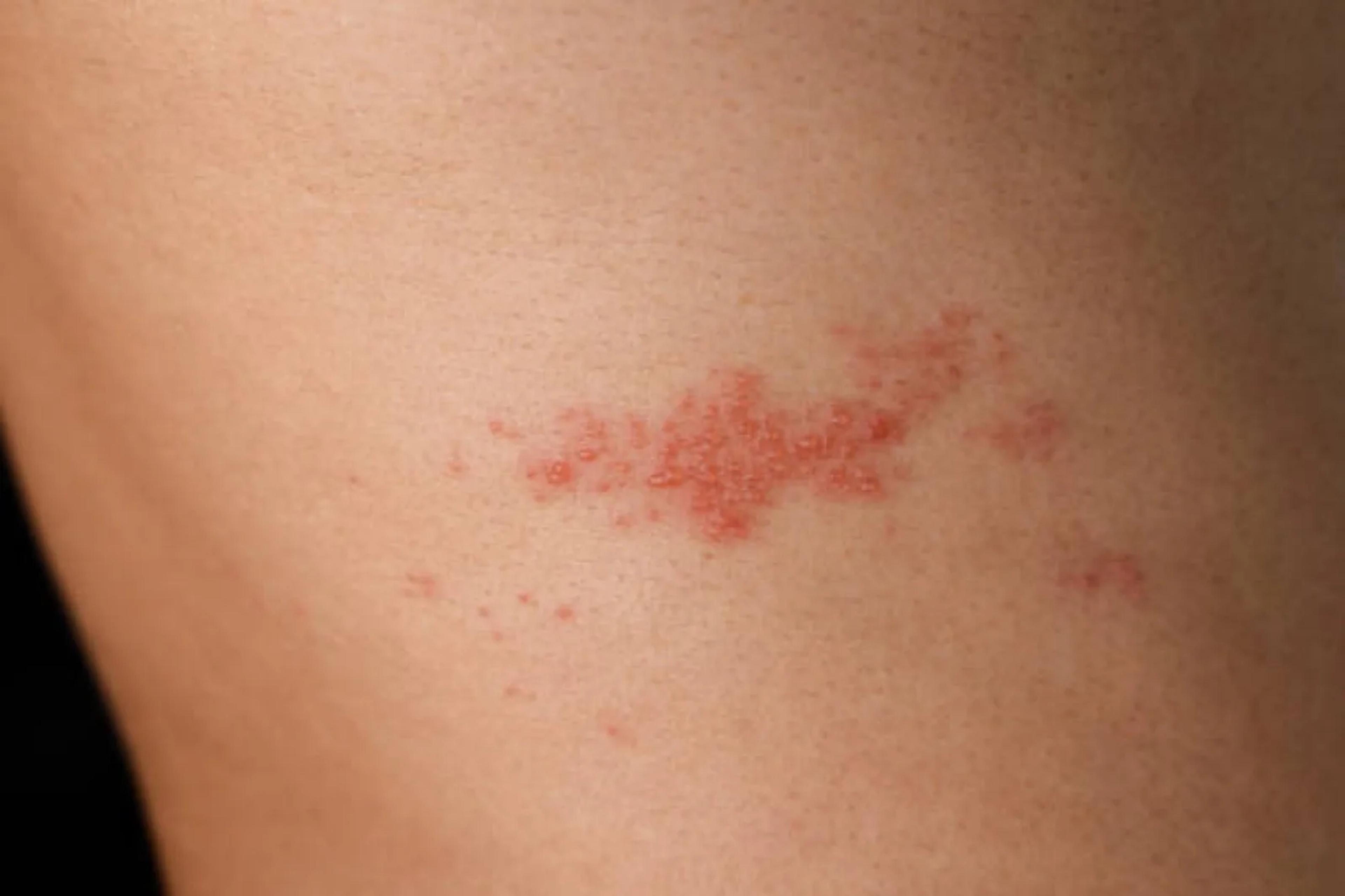 zoomed in image of shingles