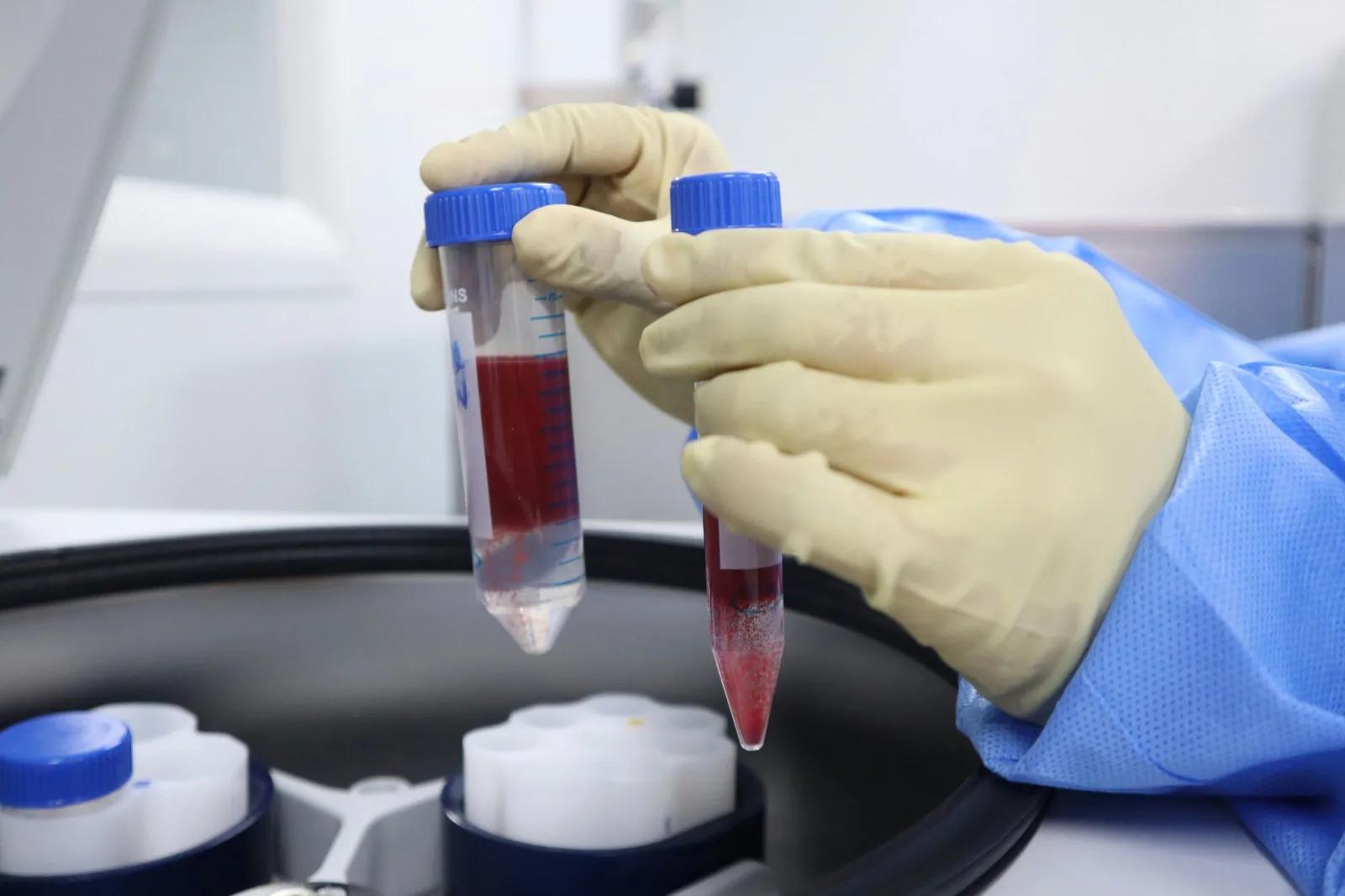 A gloved hand holding a tube of blood