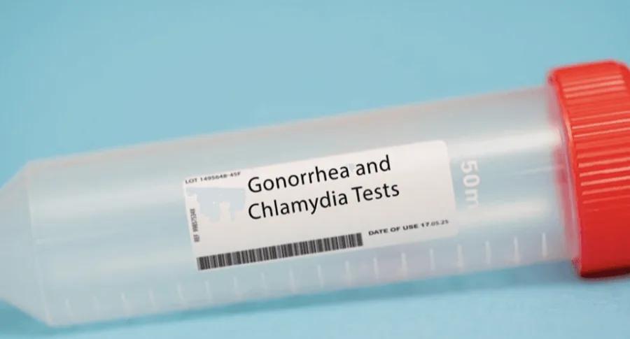 Chlamydia & Gonorrhoea Test