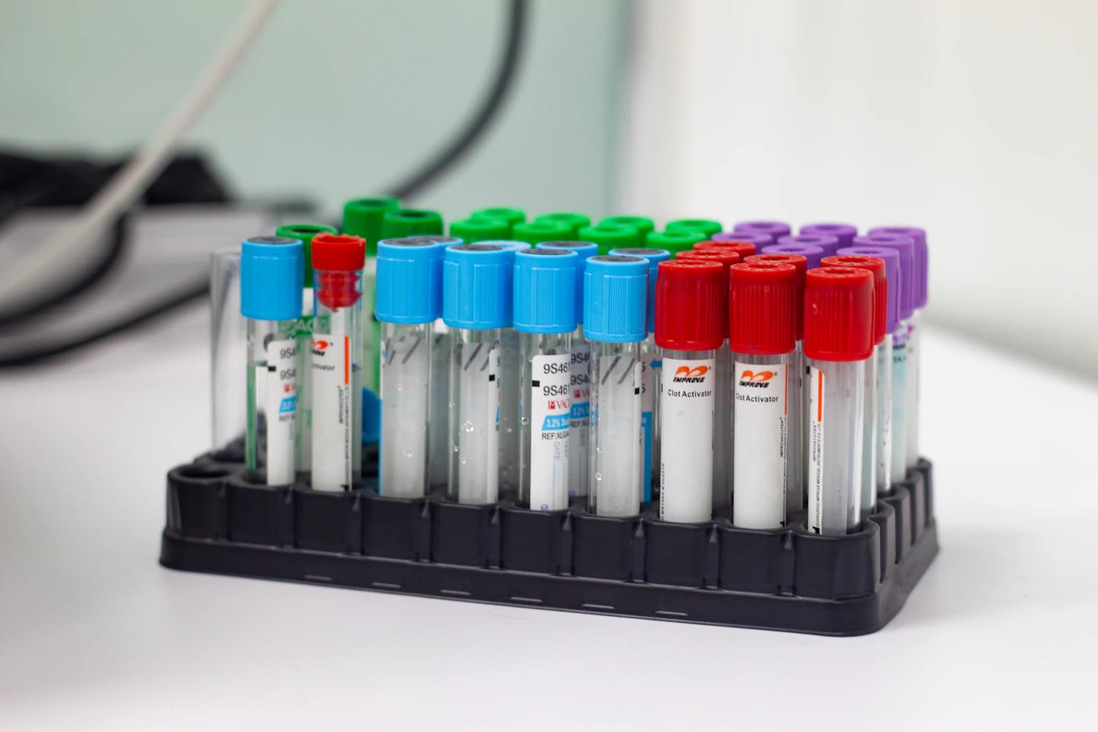 Blood sample tubes in a rack
