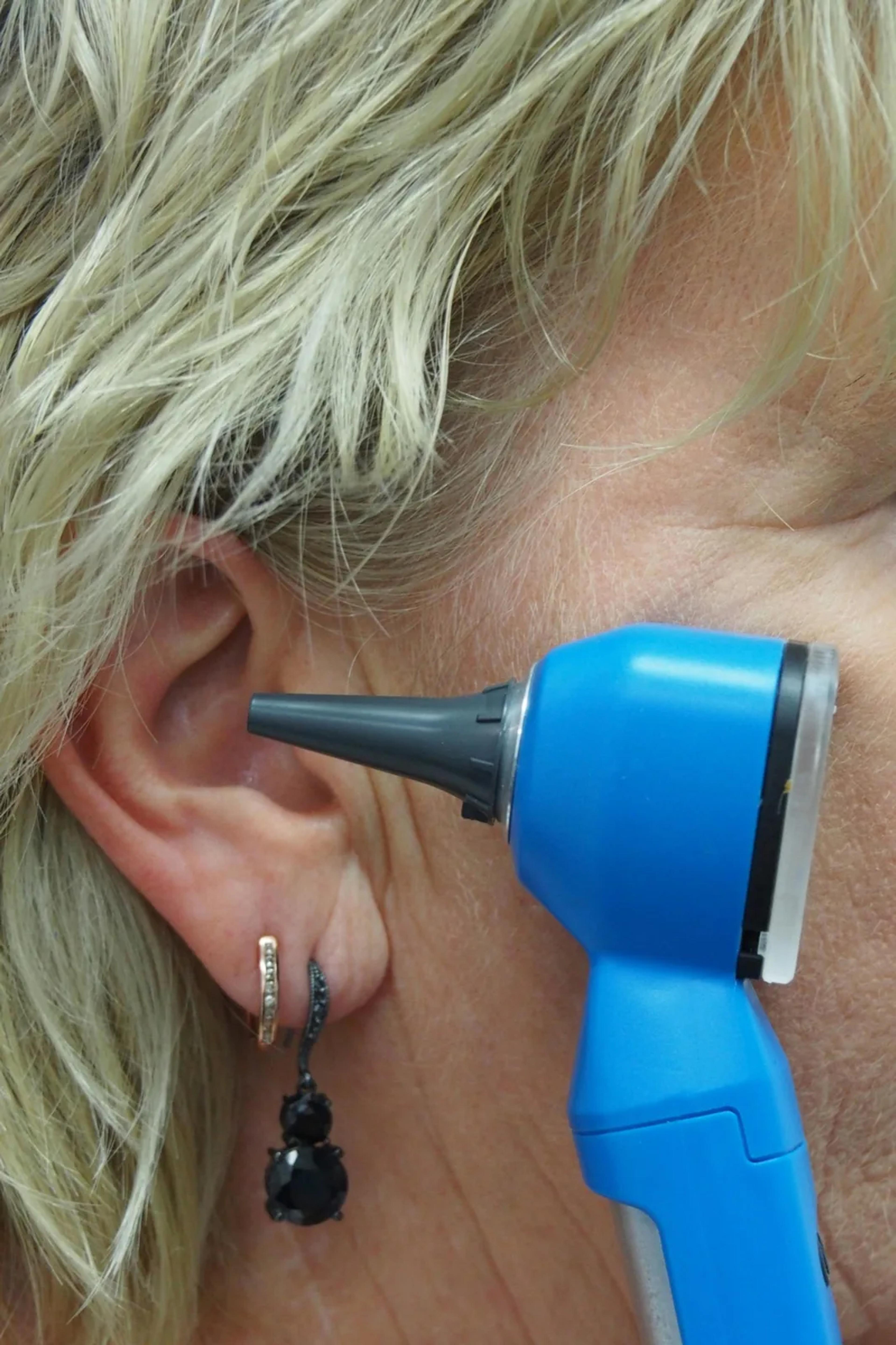 A doctor is using an otoscope to check ear.