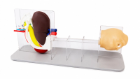 Abdominal Endoscopic Ultrasound and Biopsy Trainer