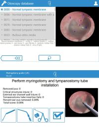 BE OTO — otoscopy simulator render