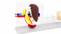 Abdominal Endoscopic Ultrasound and Biopsy Trainer