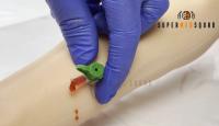 Intravenous Injection Arm Phantom