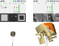 BE ENT — simulator in clinical use 2