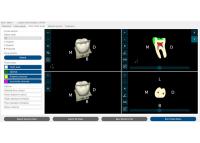 DENT.PRO — tooth cross-section slices