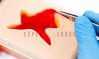 Traumatic Wound Model