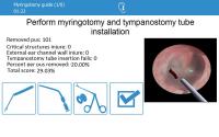 BE OTO — simulator in clinical use
