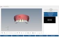 DENT.PRO — panoramic X-ray view