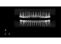 DENT.PRO — prosthetics lesson results