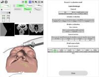 BE ENT — simulator in clinical use 1