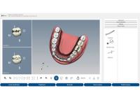 DENT.PRO — caries lesson interface