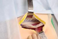 Lichtenstein Inguinal Hernia Repair Trainer