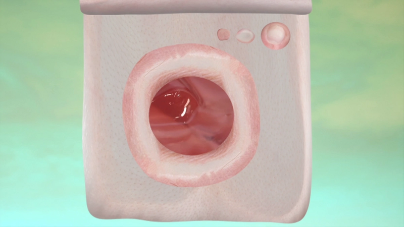 Missing alternative text