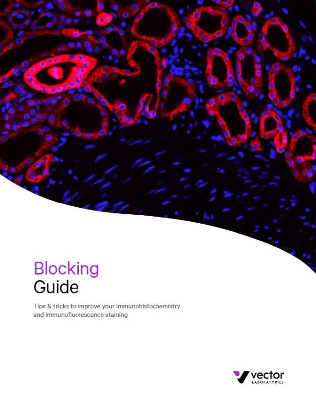 Blocking Guide