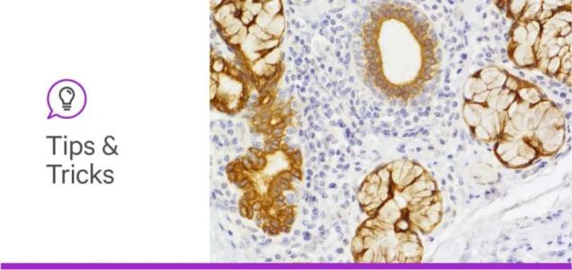 Unmasking Epitopes Using Antigen Retrieval for Formalin-Fixed Tissue Staining