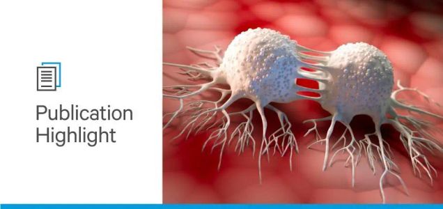 Breast Cancer Awareness Month: Impact of polysialylation in breast cancer outcomes