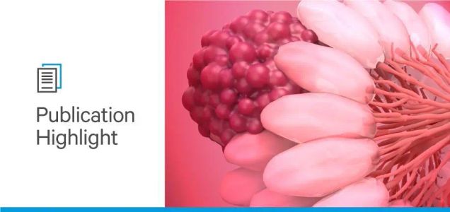 The Inhibitory Effect of Bisecting N-Acetylglucosamine on Breast Cancer