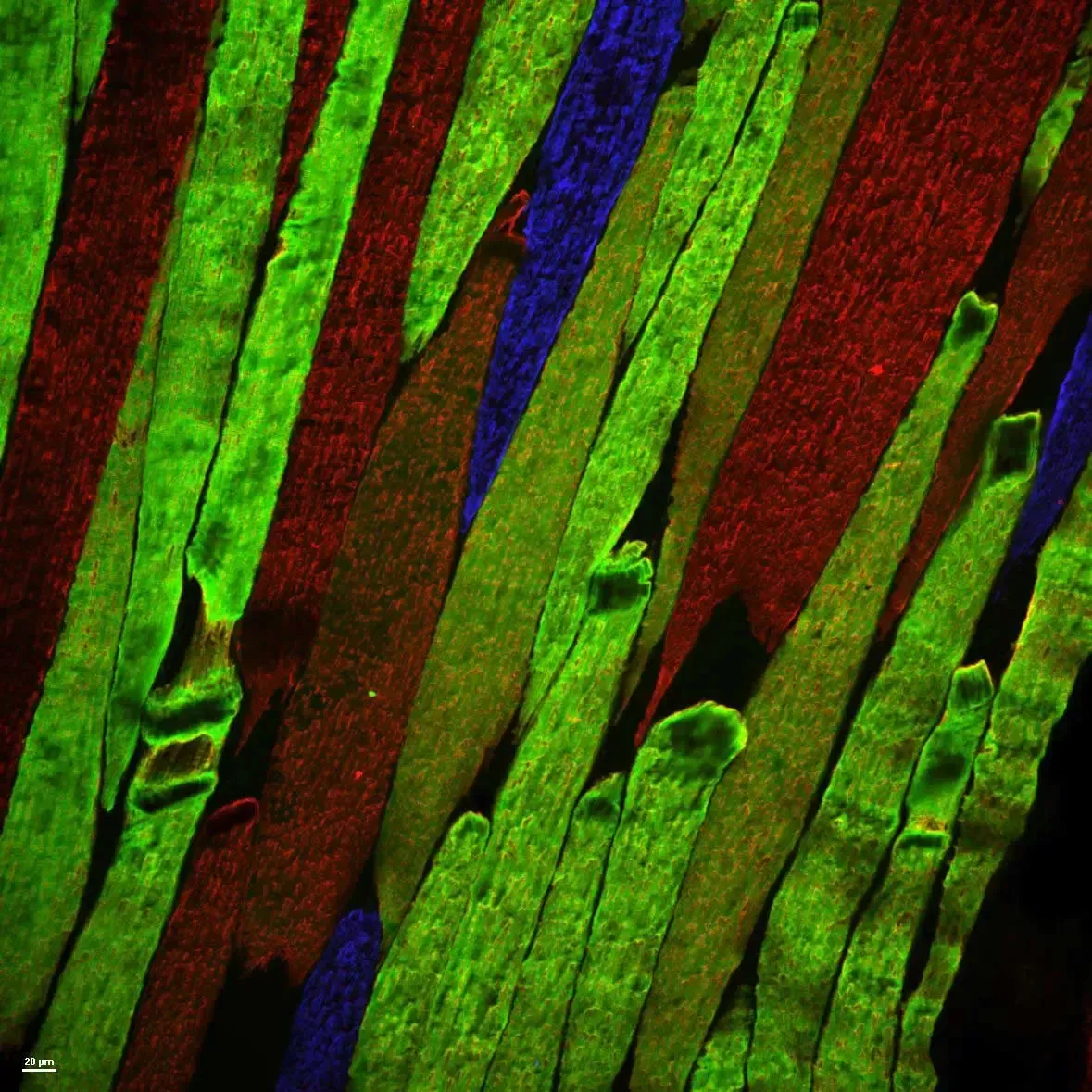 Keri.Gardner.12130 DF BGRfibertype Keri.Gardner.12130 DF BGRfibertype
