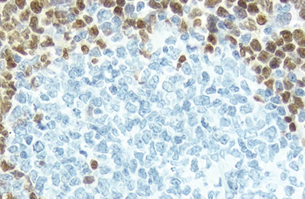 antigen retrieval figure1b 768x503 1