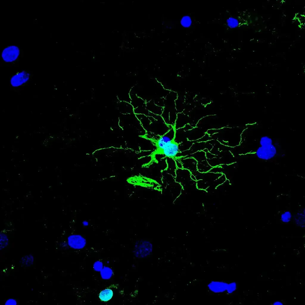 KimberlyFiock Astrocyte GFAP green DAPI blue KimberlyFiock Astrocyte GFAP green DAPI blue