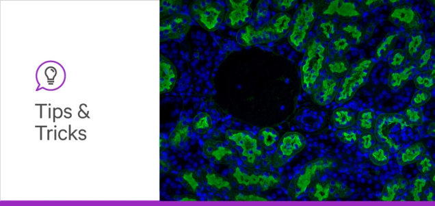 Revisiting Colon Cancer Metastasis Through a Glycobiology Lens