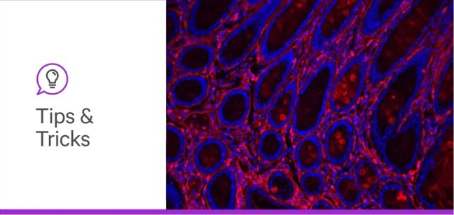 Glyco blog 1 tips and tricks header lg 1