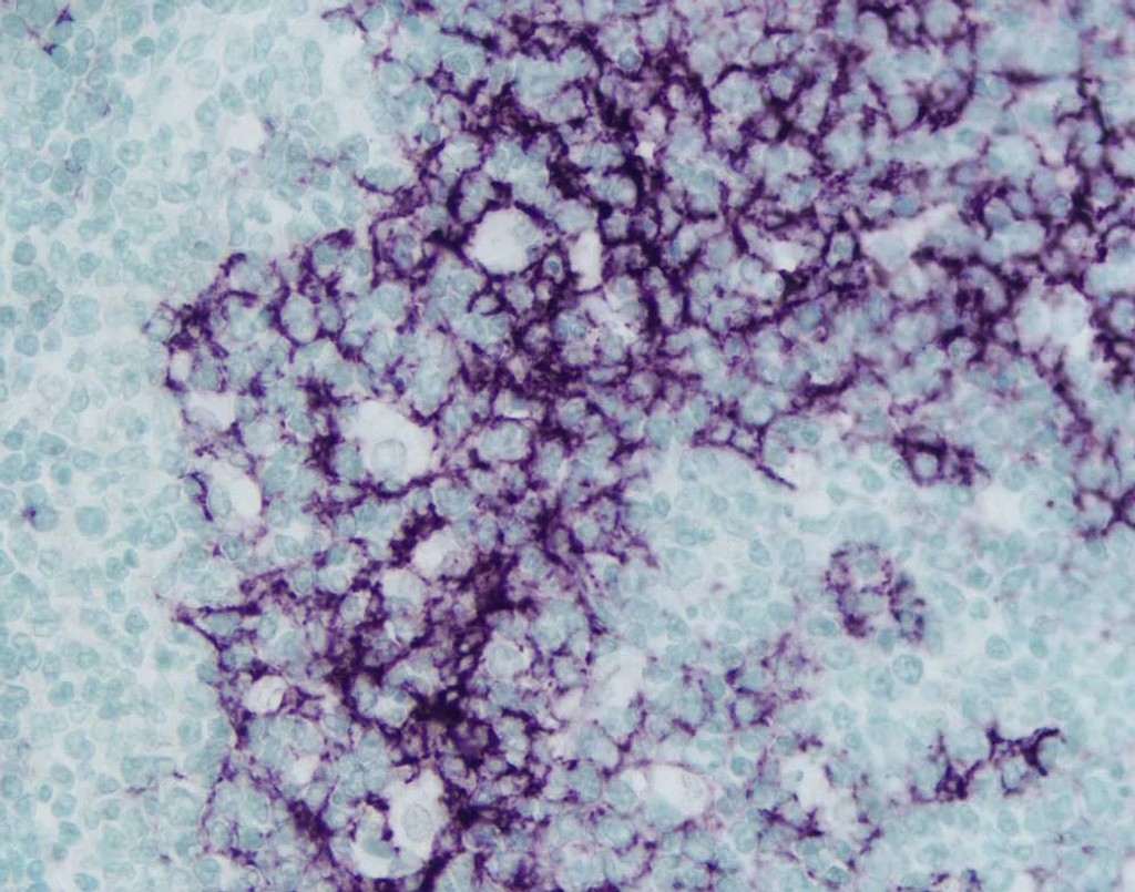 021611E 13 B Universal Ab with ELITE and ImmVIP