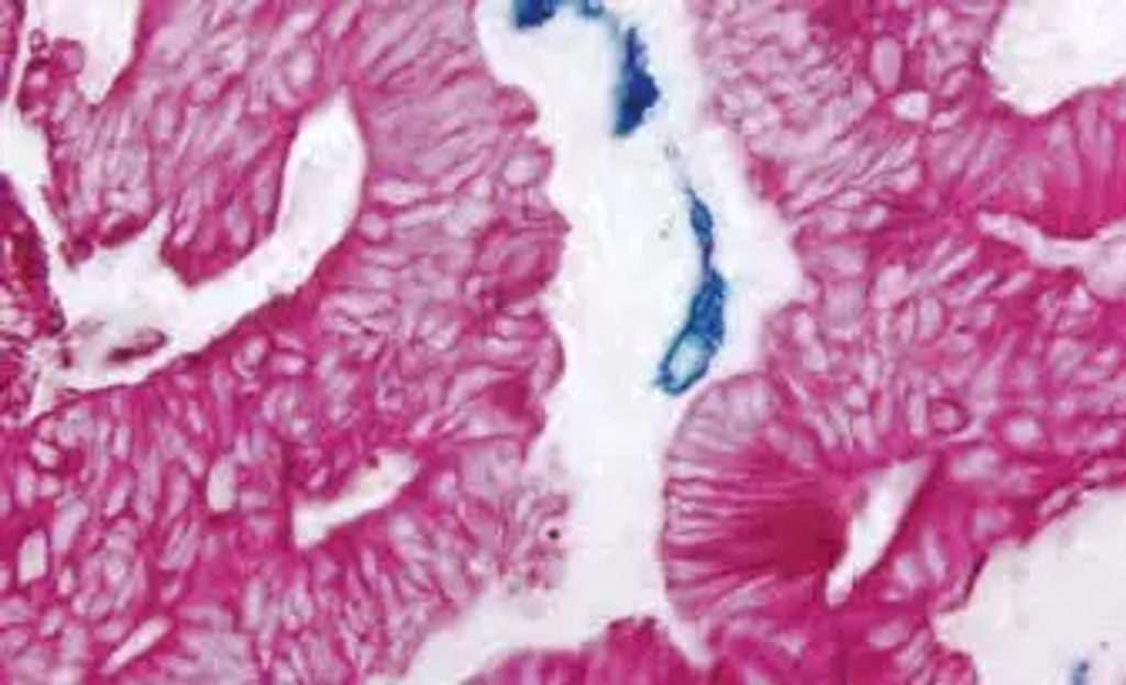 image 102