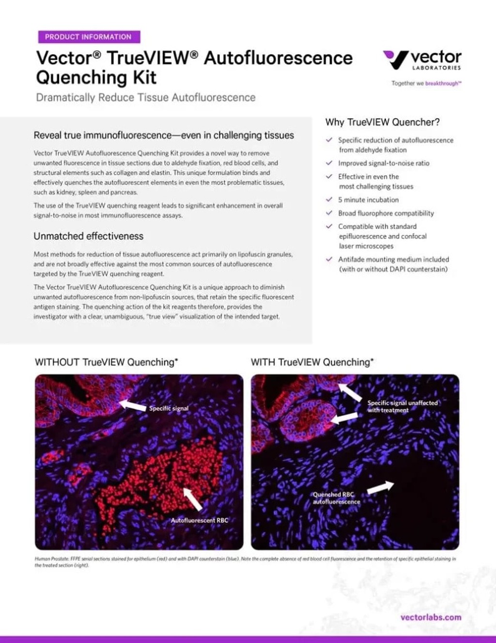VL LIT3019 TrueVIEW Brochure Cover