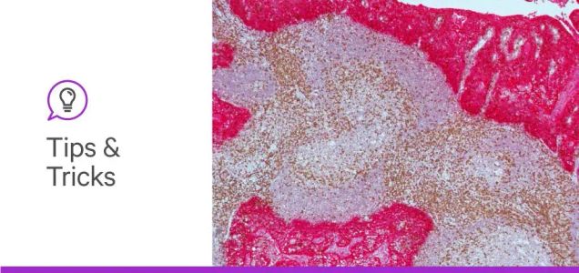 How to prevent tissue and reagent loss on your slides