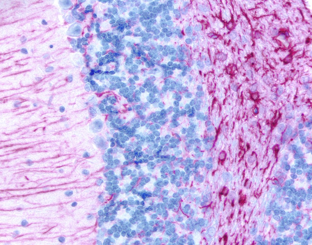 ihc adv workflow sec bckgr1 1