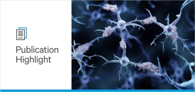 Investigating New Therapeutic Targets for Alzheimer’s Disease