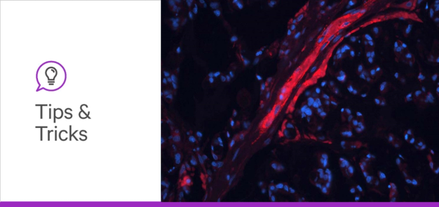 Congenital Disorders of Glycosylation: Advancing Diagnostics and Therapeutics Through Glycobiology