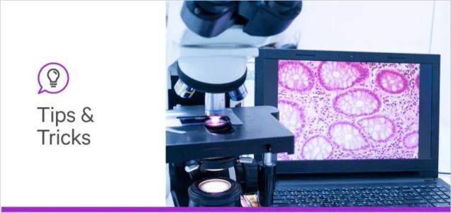 Immunostaining basics: What to know before starting