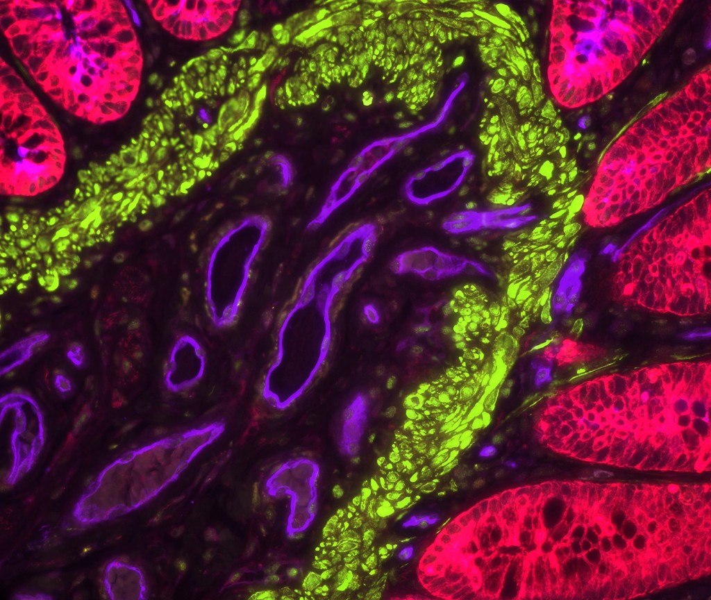 mounting media figure1 human colon