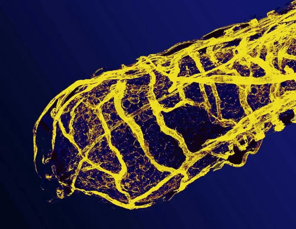 MarnaEricson vascular network 2 MarnaEricson vascular network 2