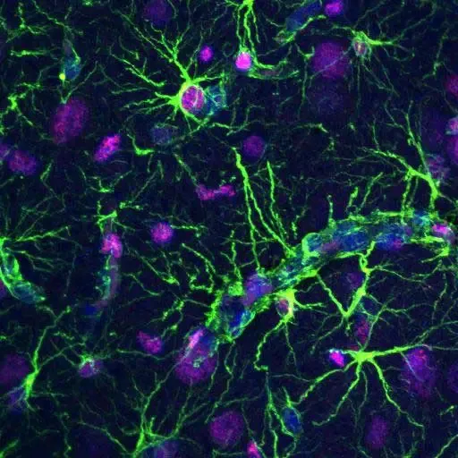 Zhengming.Wang .IF GFAP v PCNA Confocal Zhengming.Wang .IF GFAP v PCNA Confocal