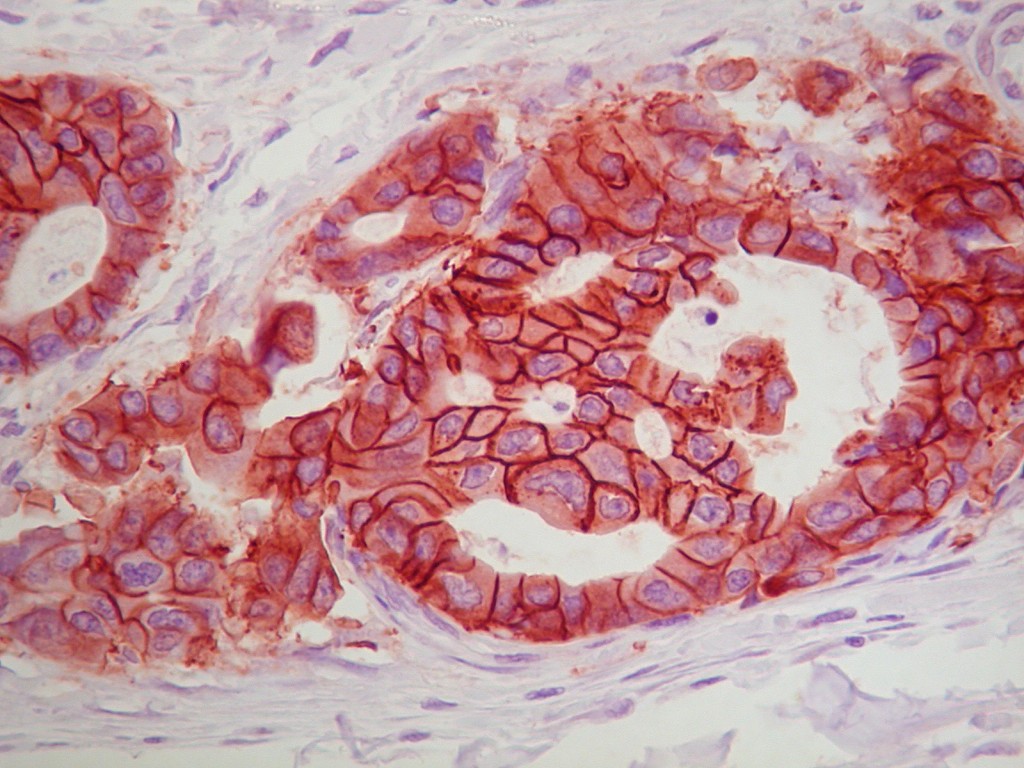 polymer sec antibodies pic1