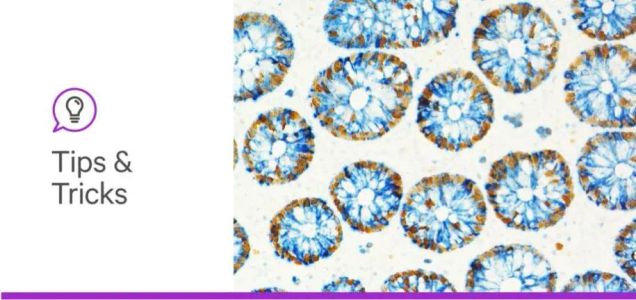 The Waiting Game: A Search for a Streamlined IHC Protocol