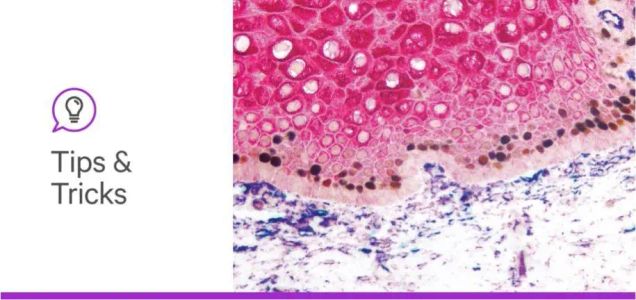 Answering Your Questions: Getting Started With Multiplex Immunohistochemistry