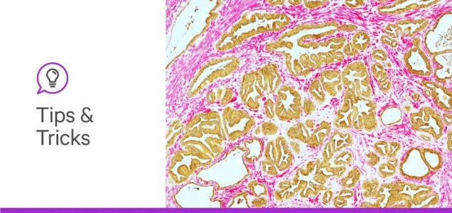My staining didn’t work, part 2: Absence of positive staining in IHC and IF