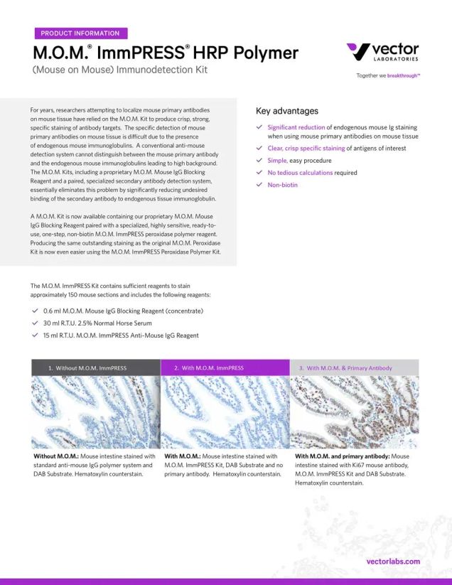 Vector M.O.M. Immunodetection
