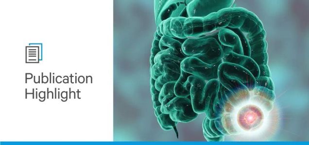 The Role of Glycans in Colorectal Cancer Progression