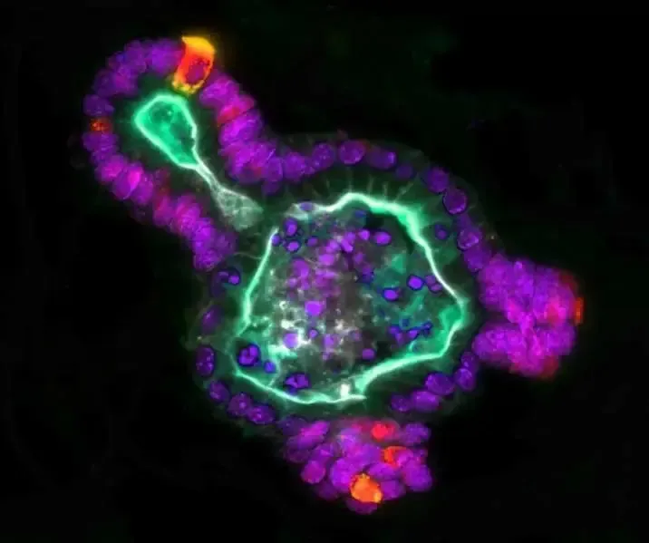 EngevikMindy Organoid EngevikMindy Organoid