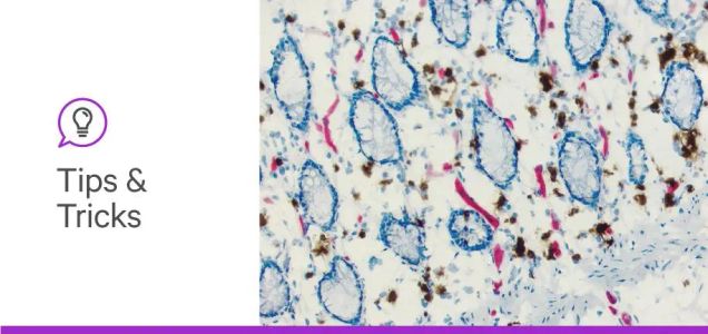 5 sources of non-specific staining and background in IHC and IF