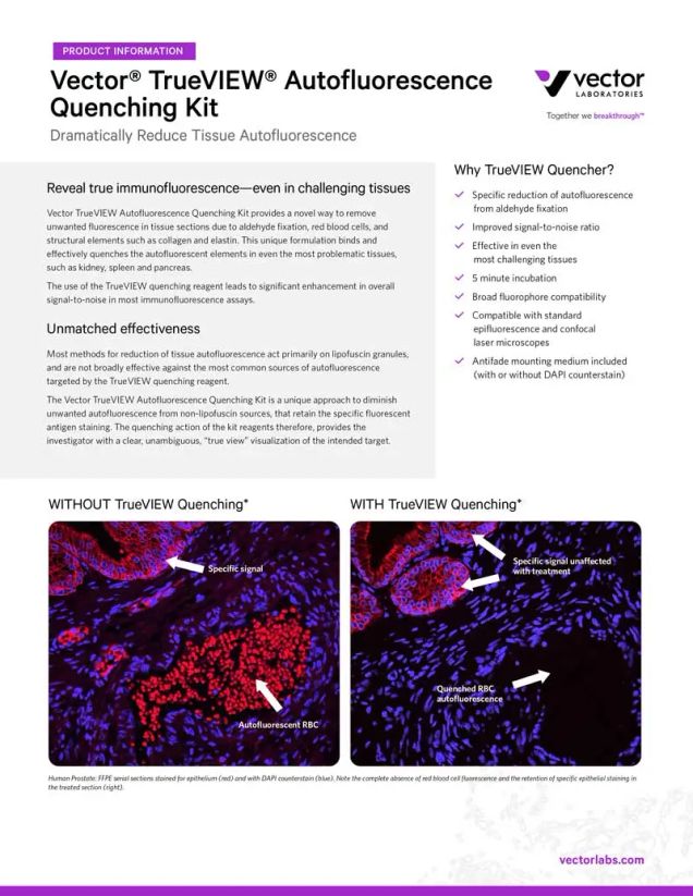 TrueVIEW Autofluorescence Quenching