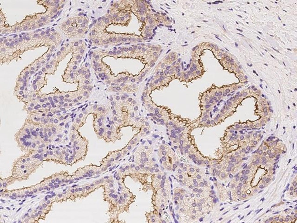 infectious disease pic1