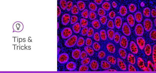 How to protect your tissue from photobleaching